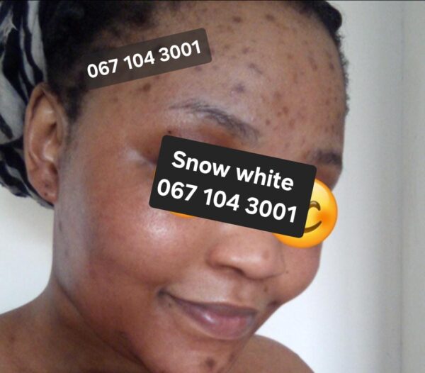 BBH Snow White Face Cream