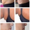 Lipo-Action Pro Weightloss Injection