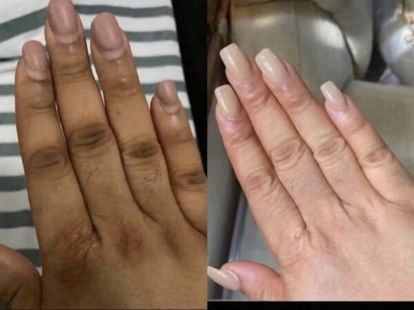 BBH Dark Knuckle Remover