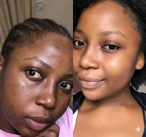 BBH Extra Face Cream